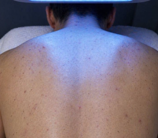 Back Facial treatment